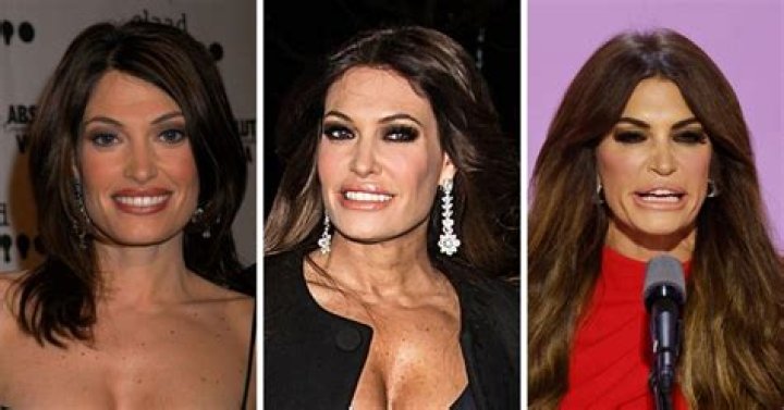 Beauty and Transformation: The Story Behind Kimberly Guilfoyle's Plastic Surgery