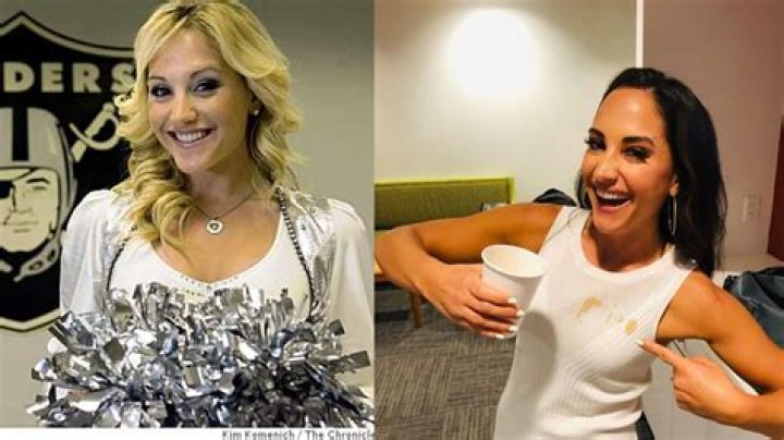 Emily Compagno Nose Job: Before & After?