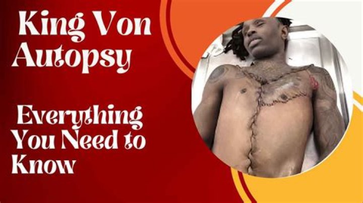 King Von Autopsy: Exclusive Details & Findings
