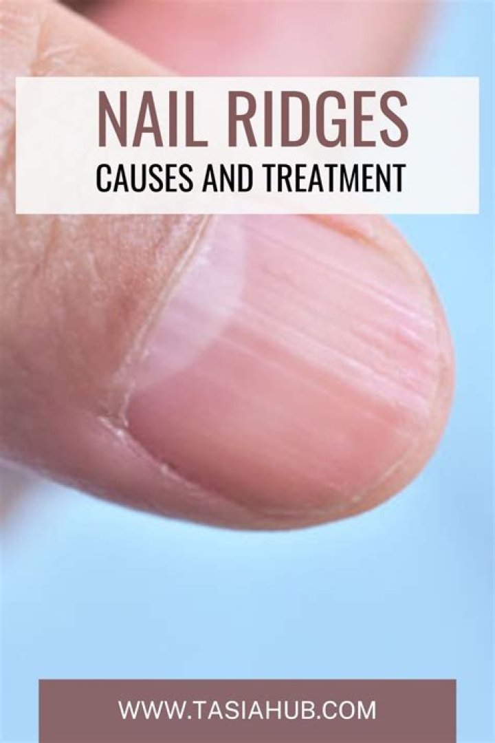 Nail Ridges Cure: Understanding Causes, Treatments, and Prevention