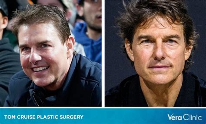 Tom Sandoval Plastic Surgery: The Untold Journey and Expert Insights